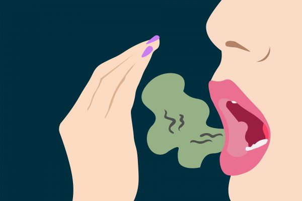 halitosis mal aliento tera